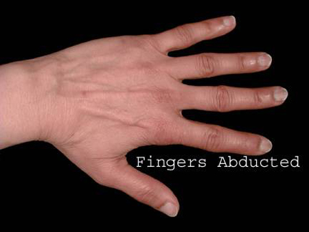 012_FingersAbducted